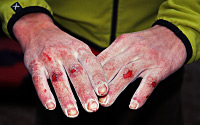 Tax of bouldering, 12. march 2015